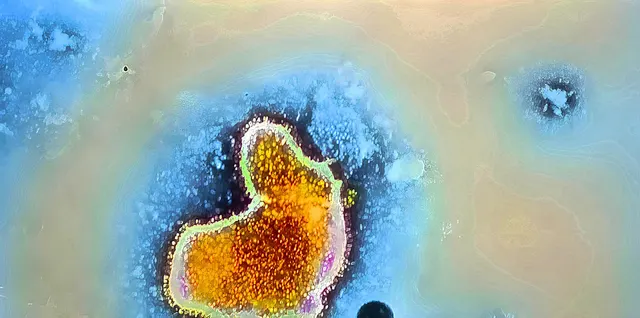 Amibă văzută la microscop, o celulă portocalie pe un fundal albastru